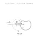 SURGICAL ACCESS SYSTEM AND RELATED METHODS diagram and image