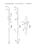 DEVICE WITH ACTIVE VALVE TO BLOCK EMESIS AND REFLUX BLOCKAGE DEVICE AND     ASSOCIATED SYSTEM AND METHOD diagram and image