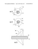 DEVICE WITH ACTIVE VALVE TO BLOCK EMESIS AND REFLUX BLOCKAGE DEVICE AND     ASSOCIATED SYSTEM AND METHOD diagram and image