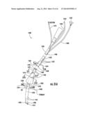 DEVICE WITH ACTIVE VALVE TO BLOCK EMESIS AND REFLUX BLOCKAGE DEVICE AND     ASSOCIATED SYSTEM AND METHOD diagram and image