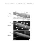 Methods and Systems for Imaging Tissue Motion Using Optical Coherence     Tomography diagram and image