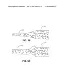 METHODS AND DEVICES FOR OCCLUDING AN OVARIAN PATHWAY diagram and image