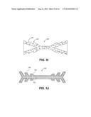 METHODS AND DEVICES FOR OCCLUDING AN OVARIAN PATHWAY diagram and image