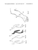 DEVICE, SYSTEM AND METHOD FOR BLOOD VESSEL IMAGING AND MARKING diagram and image