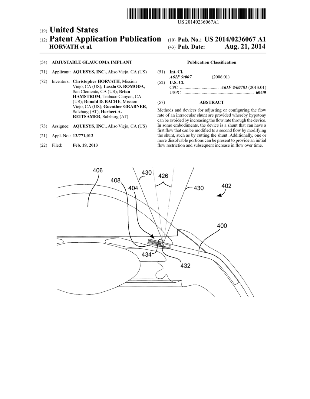 ADJUSTABLE GLAUCOMA IMPLANT - diagram, schematic, and image 01