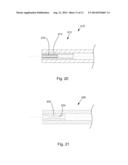 ADJUSTABLE GLAUCOMA IMPLANT diagram and image