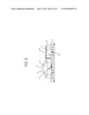 TRANSPLANTED CELL CONTAINMENT AND NUTRITION DEVICE diagram and image