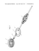 TRANSPLANTED CELL CONTAINMENT AND NUTRITION DEVICE diagram and image