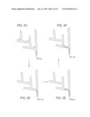 ADJUSTABLE STIFFNESS CATHETER diagram and image