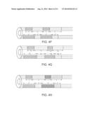 ADJUSTABLE STIFFNESS CATHETER diagram and image