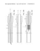 ADJUSTABLE STIFFNESS CATHETER diagram and image