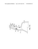 Expandable Mesh Platform for Large Area Ablation diagram and image