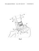 APPARATUS AND METHOD FOR AIDING VISUALIZATION AND/OR PLACING A LANDMARK     DURING A SURGICAL PROCEDURE diagram and image