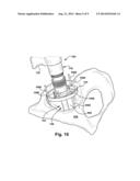 APPARATUS AND METHOD FOR AIDING VISUALIZATION AND/OR PLACING A LANDMARK     DURING A SURGICAL PROCEDURE diagram and image