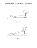 Apparatus for Removing Devices Implanted in the Body diagram and image