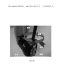 ACTUATED CANNULA SEAL diagram and image