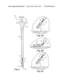 SUTURING INSTRUMENT diagram and image