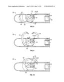 Medical Fastening Device diagram and image