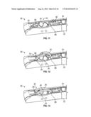 Medical Fastening Device diagram and image