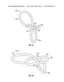 Medical Fastening Device diagram and image