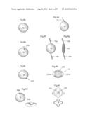 DEVICE FOR TREATING OBESITY diagram and image