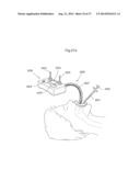 DEVICE FOR TREATING OBESITY diagram and image