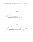 DEVICE FOR TREATING OBESITY diagram and image