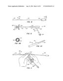 MEDICAL DEVICE AND METHOD diagram and image