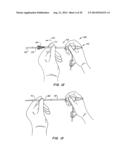 MEDICAL DEVICE AND METHOD diagram and image