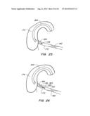 MEDICAL DEVICE AND METHOD diagram and image