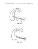 MEDICAL DEVICE AND METHOD diagram and image