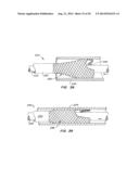 MEDICAL DEVICE AND METHOD diagram and image