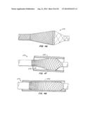 MEDICAL DEVICE AND METHOD diagram and image