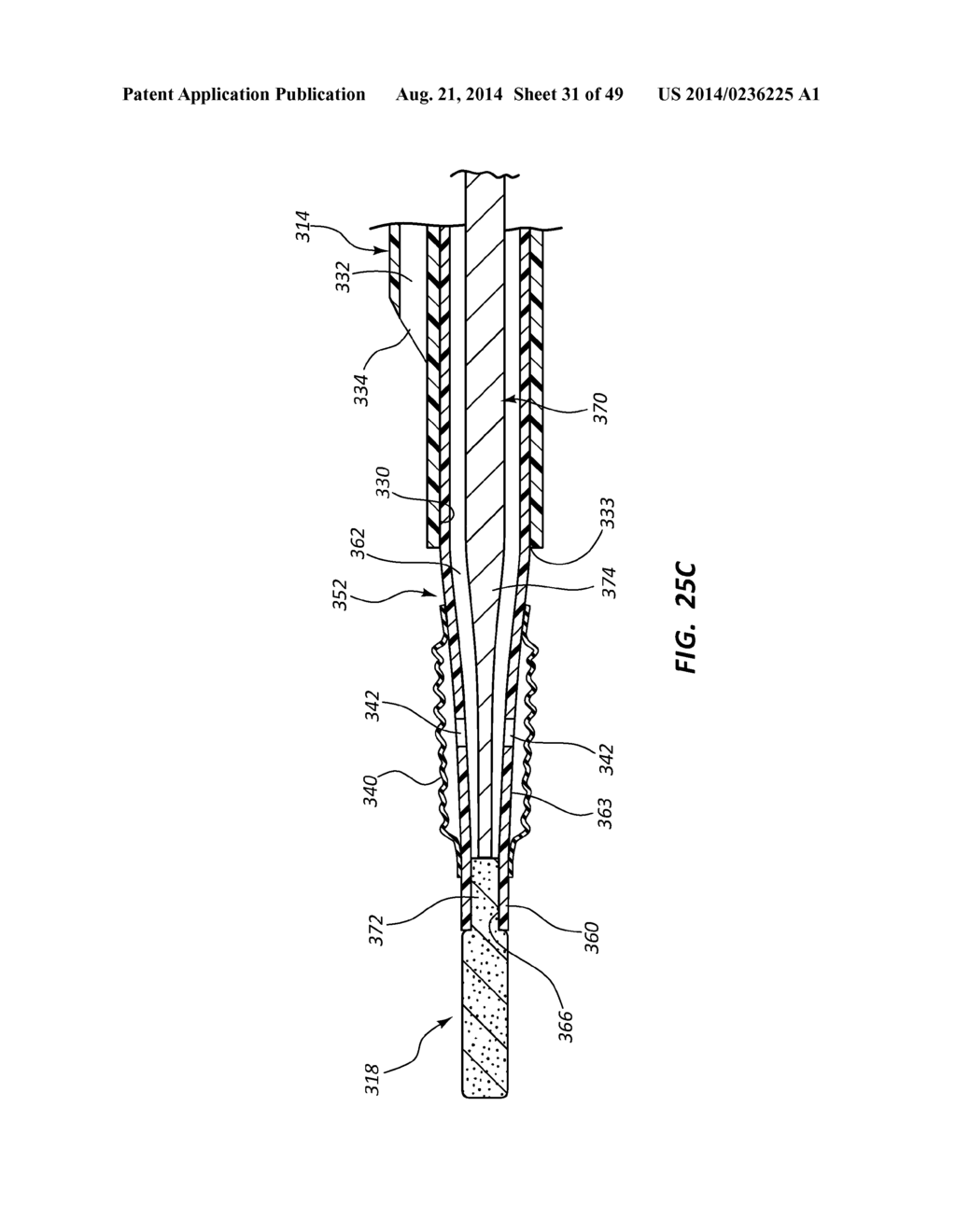 BIOADHESIVE DELIVERY SYSTEMS AND METHODS FOR VASCULAR CLOSURE - diagram, schematic, and image 32