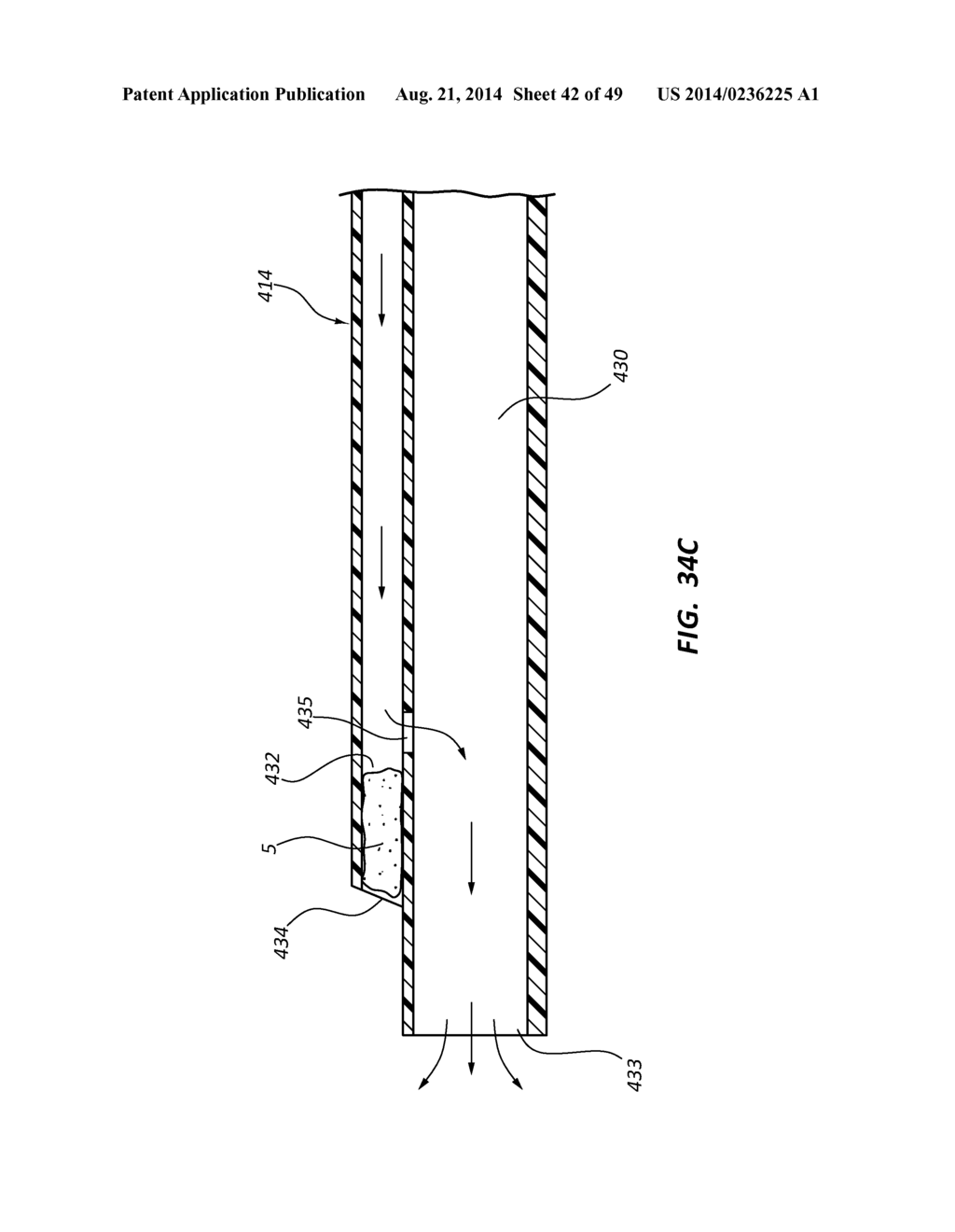 BIOADHESIVE DELIVERY SYSTEMS AND METHODS FOR VASCULAR CLOSURE - diagram, schematic, and image 43