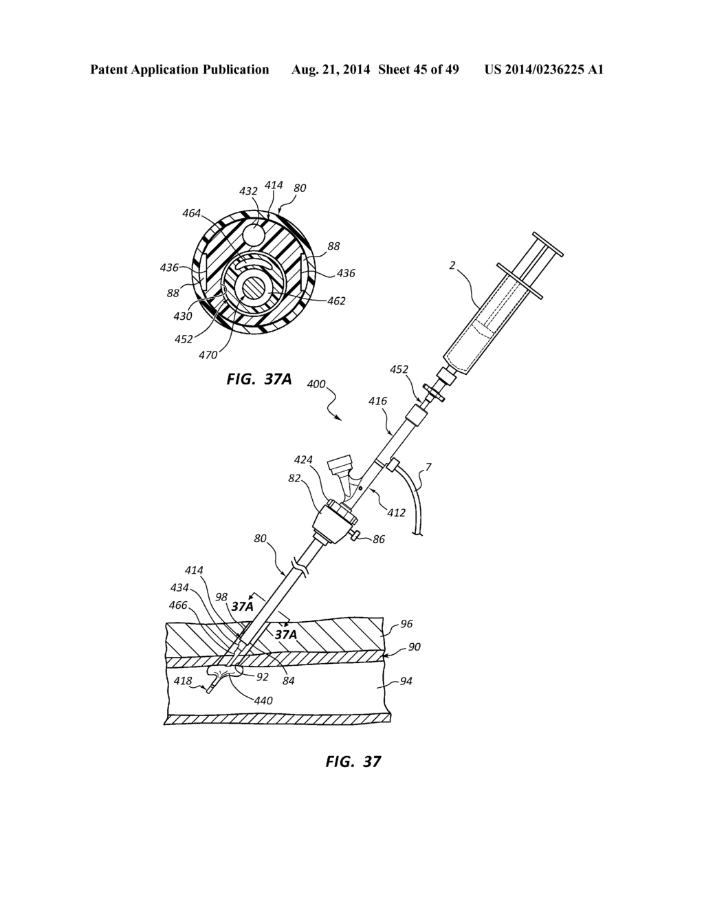 BIOADHESIVE DELIVERY SYSTEMS AND METHODS FOR VASCULAR CLOSURE - diagram, schematic, and image 46