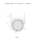 SURGICAL IMPLANT SYSTEM AND METHOD diagram and image