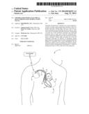 CRITERIA FOR OPTIMAL ELECTRICAL RESYNCHRONIZATION DURING FUSION PACING diagram and image