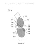 METHOD FOR MODIFYING BIOCOMPATIBILITY CHARACTERISTICS OF A SURFACE OF A     BIOLOGICAL MATERIAL WITH GAS CLUSTER ION BEAM diagram and image