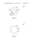 REVERSE JOINT REPLACEMENT DEVICE AND METHODS THEREOF diagram and image