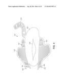 Bottom-Down Last For 3D Forming diagram and image