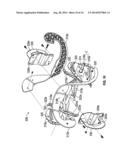 SNOWTHROWER IMPELLER ASSEMBLY WITH RIGID CUTTING IMPLEMENT diagram and image