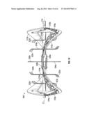 SNOWTHROWER IMPELLER ASSEMBLY WITH RIGID CUTTING IMPLEMENT diagram and image