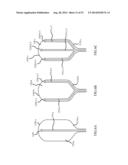 TRANSMITTING TORQUE WITH A HANDLE TO AN OPERATIVE ELEMENT THROUGH A     WORKING CHANNEL diagram and image