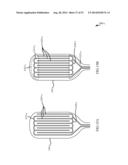 TRANSMITTING TORQUE WITH A HANDLE TO AN OPERATIVE ELEMENT THROUGH A     WORKING CHANNEL diagram and image