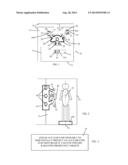 EXTERNAL BEAM RADIATION THERAPY FOR A PLURALITY OF COMPARTMENTS diagram and image