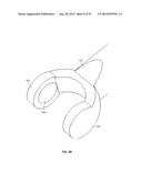 Electrochemical Fabrication Method Including Elastic Joining of Structures diagram and image