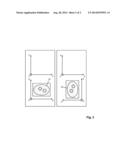 MR ELECTRICAL PROPERTIES TOMOGRAPHY diagram and image