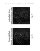 Imaging System and Method for Use in Surgical and Interventional Medical     Procedures diagram and image