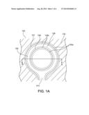 PASSIVATION OF RING ELECTRODES diagram and image